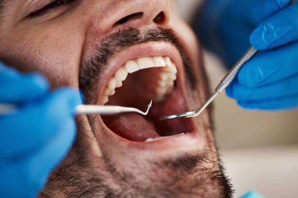 Best Emergency Gum Treatment in Benton, KY